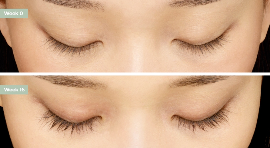 Latisse 5ML - 10-Week Supply